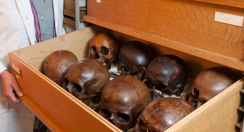 Crânes médiévaux de moines provenant d'un cimetière de Coxyde conservés à l'IRSNB.