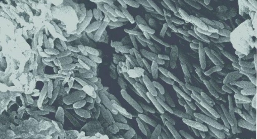 Images au microscope électronique