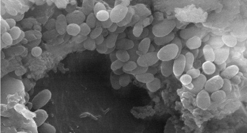 Images au microscope électronique